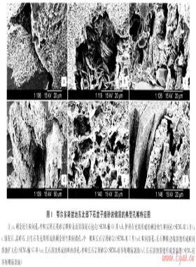 鄂爾多斯盆地東北部下石盒子組致密砂巖儲層特征及主控因素